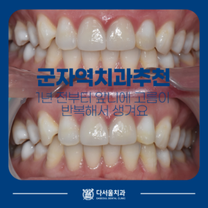 치료전후
