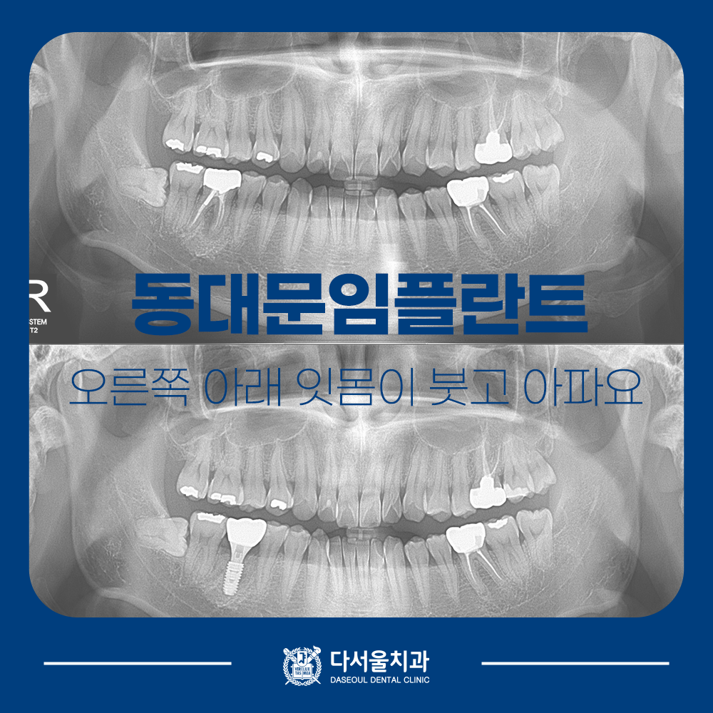 답십리치과
