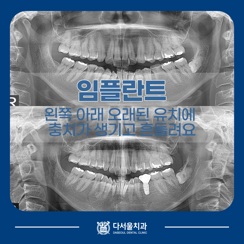 성동구치과

