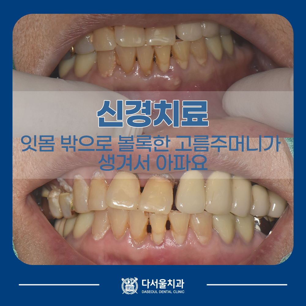 성동구치과 