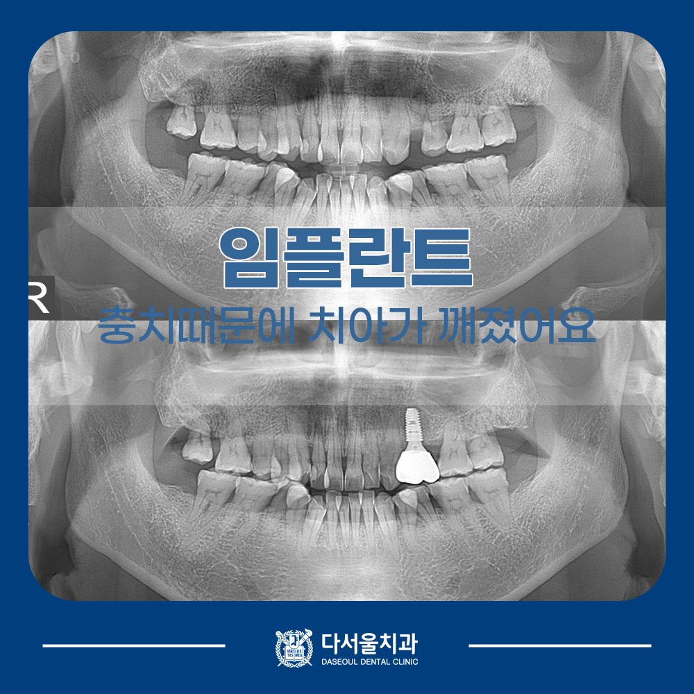 장한평치과
