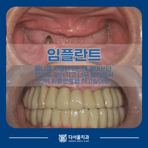 용답동치과