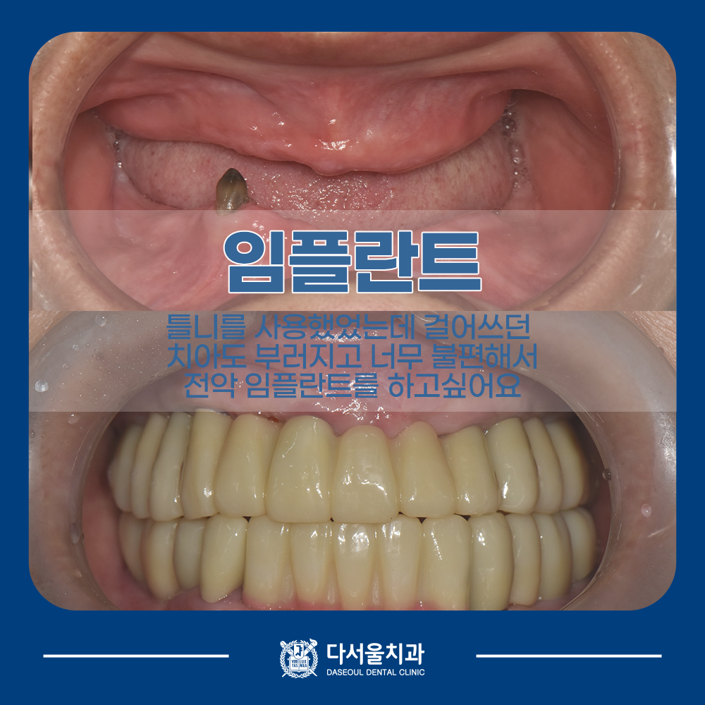 용답동치과 