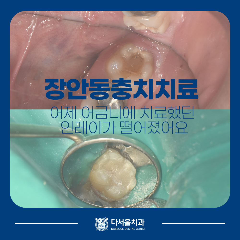 장안동치과 
