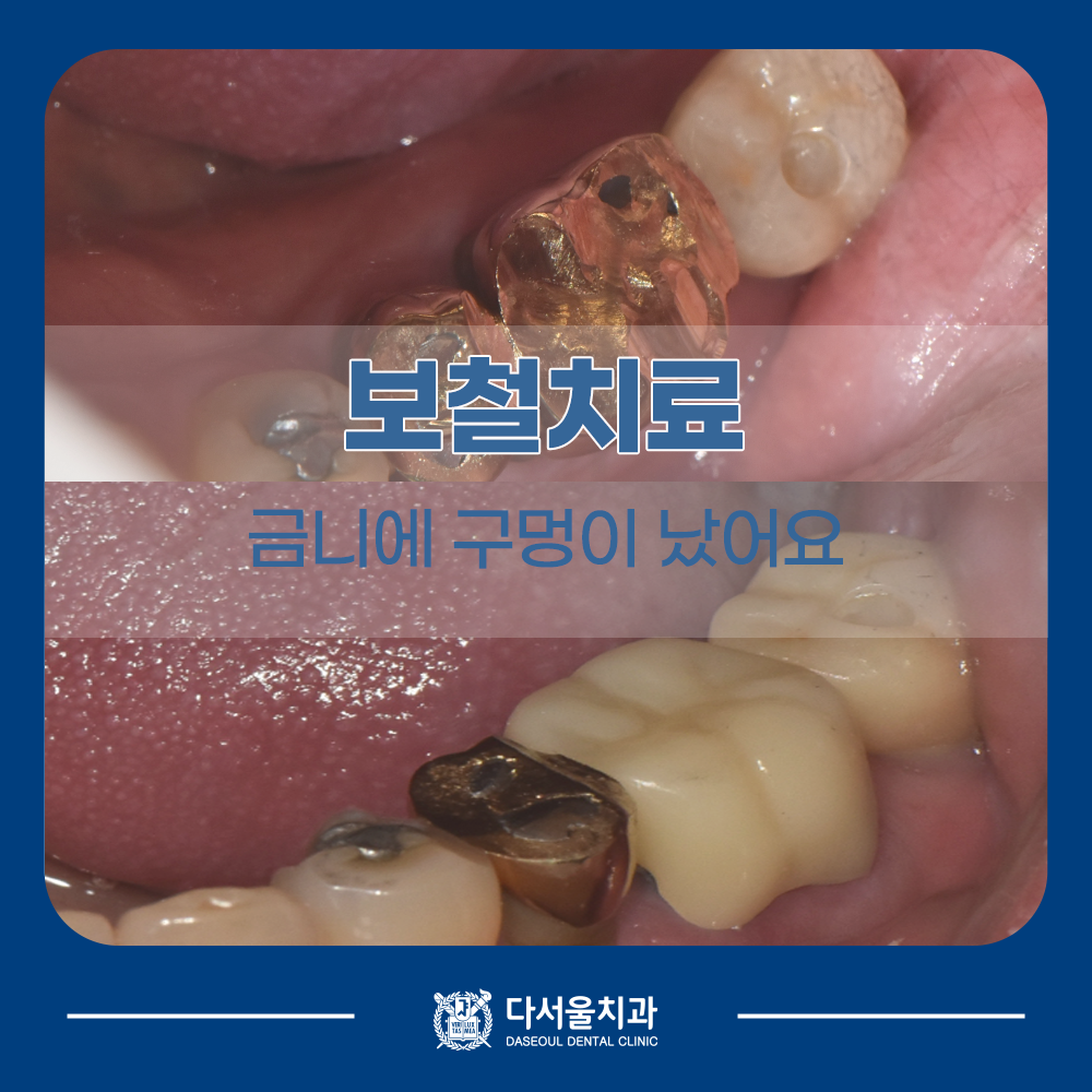 성동구치과
