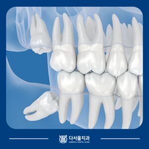 장안동치과