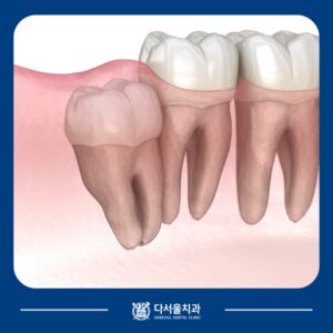 장안동치과